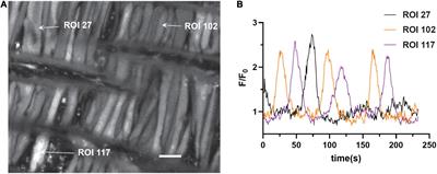 Long-Term Hypoxia Negatively Influences Ca2+ Signaling in Basilar Arterial Myocytes of Fetal and Adult Sheep